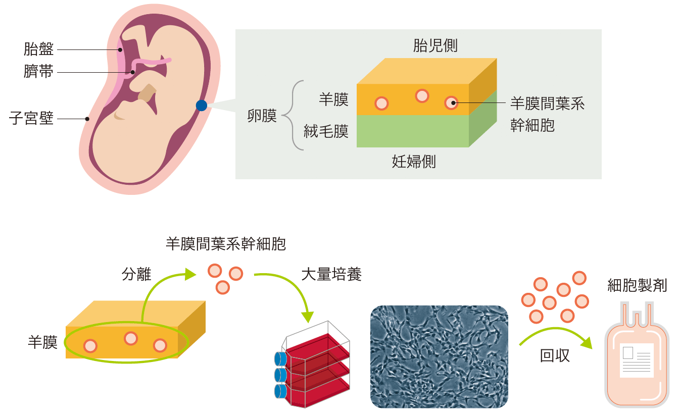 羊膜間葉系幹細胞製剤の開発