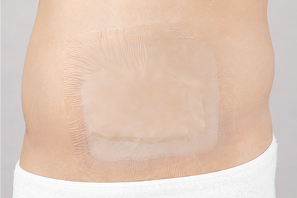 アルケア社のバスラックシール